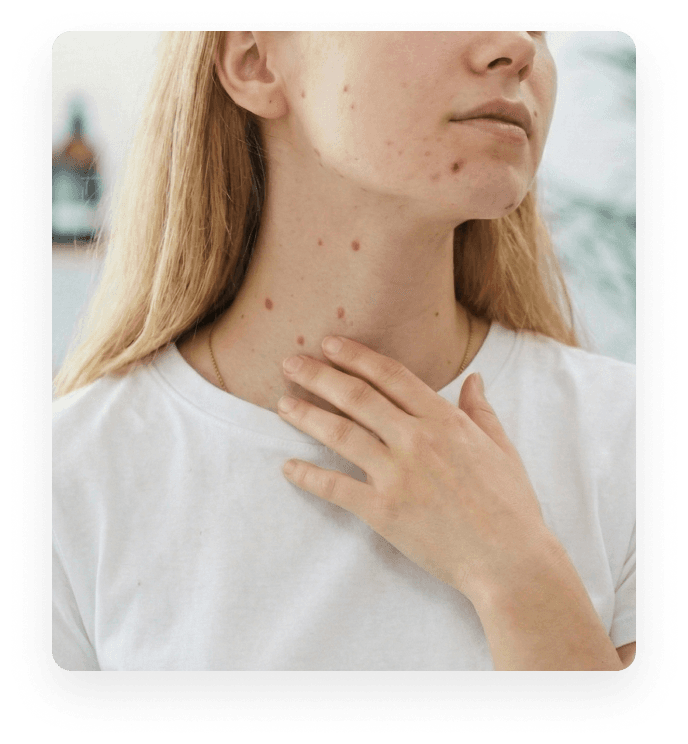 Dermatologas dermatoskopu tiria paciento kaklo apgamus Dermatologas dermatoskopu tiria paciento kaklo apgamus